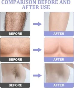 Livingful Premium Crystal Hair Removal • Pijnloos Ontharing Epileerapparaat Voor Armen Benen Rug• Mannen En Vrouwen • Epilator Voor Langdurige Ontharing • Snelle En Gemakkelijke Exfoliërende Ontharin • Haarverwijderaar • Kristalpad • Zijdezachte Huid -Verzorgingsproducten 1005x1200 1