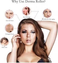 Dermaroller 0.5 Mm & Desinfectie Alcohol Spray - 540 Naalden - Steriel Verpakt -Verzorgingsproducten 1111x1200 2