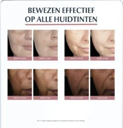 Eucerin Anti-Pigment Nachtcrème - 50 Ml -Verzorgingsproducten 1157x1200 7