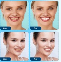 Diamond White - Teeth Whitening Strips - 28x Strips - Zonder Peroxide (0%) - Tandenbleekset - Tandenbleek Strips – Mint -Verzorgingsproducten 1185x1200 8