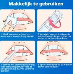 B-care Tanden Bleekpen - Teeth Whitening Pen - Tanden Bleker - Wittere Tanden - Teeth Whitening Strips - Professioneel Resultaat - Tandsteen Verwijderaar - Zonder Peroxide - Tandenbleekset - Tanden Bleken -Verzorgingsproducten 1185x1200 9