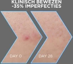 Garnier PureActive AHA + BHA Charcoal Anti-Onzuiverheden Serum - 30ml -Verzorgingsproducten 1200x1055 1