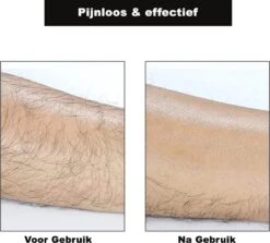 Crystal Hair Removal - Crystal Hair Eraser - Bleame - Kristalpad - Ontharing - Pijnloos - TikTok - Crystal Hair Remover - Haarverwijderaar -Verzorgingsproducten 1200x1082 1