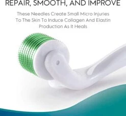 Kingsowned Derma Roller 1.5 Mm, 540 Naalden - Steriel Verpakt - Hoge Kwaliteit Chirurgisch Staal - Bewezen Effectief Tegen Rimpels, Acne Littekens, En Cellulitis & Stimulatie Van Haargroei Op De Hoofdhuid, Baardgroei -Verzorgingsproducten 1200x1108 5