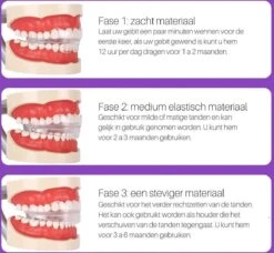 Edoir Rechte Tanden Beugel - Retainer Voor Rechte Tanden - Rechte Tanden Bitje -Verzorgingsproducten 1200x1109 2