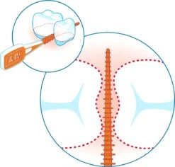 Tepe EasyPick Paars Maat XL – 36 Stuks -Verzorgingsproducten 1200x1146 4