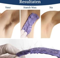STATCH Wax Apparaat Ontharing Set Met 500 Gram Wax Bonen En 25 Houten Spatels - 12 STATCH Wax Apparaat Ontharing Set Met 500 Gram Wax Bonen En 25 Houten Spatels - -Verzorgingsproducten 1200x1158 2