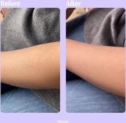 Livingful Premium Crystal Hair Removal • Pijnloos Ontharing Epileerapparaat Voor Armen Benen Rug• Mannen En Vrouwen • Epilator Voor Langdurige Ontharing • Snelle En Gemakkelijke Exfoliërende Ontharin • Haarverwijderaar • Kristalpad • Zijdezachte Huid -Verzorgingsproducten 1200x1166 1