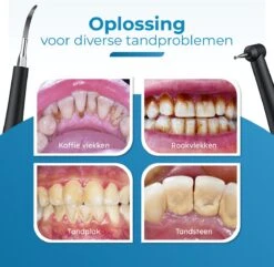 Professionele Tandsteen Verwijderaar - 5 Standen - Inclusief Tandarts Set - Met 3 Opzetstukken - Elektrisch - Tandplak -Verzorgingsproducten 1200x1169 16