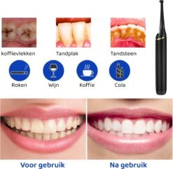 ExCorn Elektrische Tandsteen Verwijderaar - Inclusief 6-delig Tandartsset - 3 Standen - Elektrisch Tandplak Verwijderen - Tanden Polijsten -Verzorgingsproducten 1200x1173 3