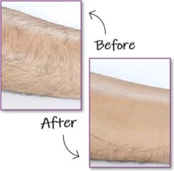 EPC® Duo Crystal Hair Removal Pad - Ontharings Pad - Pijnloos Ontharen - Kristal Haarverwijderaar - Scrubi - Ontharing Eraser Kristalpad - Bleame - Armen Benen Bikinilijn - Roze -Verzorgingsproducten 1200x1177 5