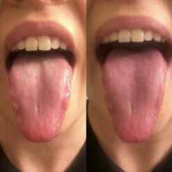 Orabrush Tongreiniger 9 Orabrush Tongreiniger -Verzorgingsproducten 1200x1197 21