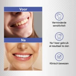 Merkloos Tanden Bleken Met 14 Sets Whitening Strips - Tandenbleekset Met Bamboe Tandenborstel - Tanden Bleekstrips -Verzorgingsproducten 1200x1200 1155