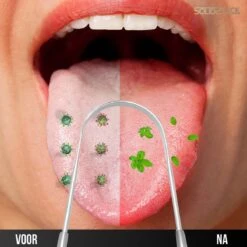 SolidStock Professionele Tongschraper Voor Mondverzorging - 4 Delige Tongreiniger - Ayurveda - RVS -Verzorgingsproducten 1200x1200 1177