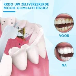 DEN-T® PRO P350 Elektrische Tandenpolijster - Wit - 5 Standen - 5 Opzetstukken - Polijstmachine - Polijstset - Tanden Polijsten - -Verzorgingsproducten 1200x1200 1381