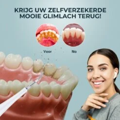 Merkloos Tandsteen Verwijderaar Elektrisch – Tandenborstel Opzetstukken - Tandarts Spiegel - 5 Standen -Wit 14 Merkloos Tandsteen Verwijderaar Elektrisch – Tandenborstel Opzetstukken - Tandarts Spiegel - 5 Standen -Wit -Verzorgingsproducten 1200x1200 1459