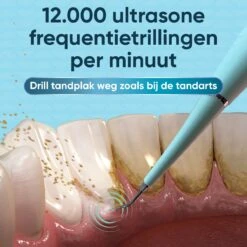 Whitee Elektrische Tandsteen Verwijderaar - Tanden Polijsten - Tandarts Tandsteenverwijderaars - Elektrisch Tandplak Verwijderen 15 Whitee Elektrische Tandsteen Verwijderaar - Tanden Polijsten - Tandarts Tandsteenverwijderaars - Elektrisch Tandplak Verwijderen -Verzorgingsproducten 1200x1200 1473