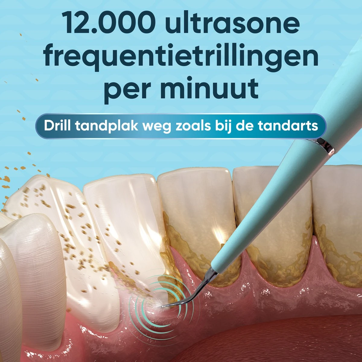 Whitee Elektrische Tandsteen Verwijderaar - Tanden Polijsten - Tandarts Tandsteenverwijderaars - Elektrisch Tandplak Verwijderen 5 Whitee Elektrische Tandsteen Verwijderaar - Tanden Polijsten - Tandarts Tandsteenverwijderaars - Elektrisch Tandplak Verwijderen - Afbeelding 5