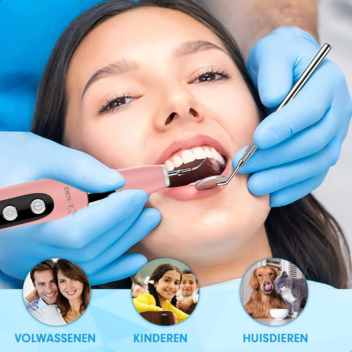 DEN-T® PRO U500 - Elektrische Sonische Tandsteen Verwijderaar - Roze 4 DEN-T® PRO U500 - Elektrische Sonische Tandsteen Verwijderaar - Roze - Afbeelding 4