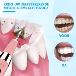DEN-T® PRO U500 - Elektrische Sonische Tandsteen Verwijderaar - Roze 18 DEN-T® PRO U500 - Elektrische Sonische Tandsteen Verwijderaar - Roze -Verzorgingsproducten 1200x1200 1489