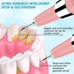 DEN-T® PRO U500 - Elektrische Sonische Tandsteen Verwijderaar - Roze 20 DEN-T® PRO U500 - Elektrische Sonische Tandsteen Verwijderaar - Roze -Verzorgingsproducten 1200x1200 1491