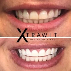 Xtrawit - Teeth Whitening Strips - Tandenbleekset - Wittere Tanden - Goedgekeurde Tandenbleek Strips - 30 Strips 10 Xtrawit - Teeth Whitening Strips - Tandenbleekset - Wittere Tanden - Goedgekeurde Tandenbleek Strips - 30 Strips -Verzorgingsproducten 1200x1200 1599