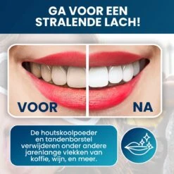 Tandenbleekset - Teeth Whitening - Teeth Whitener - Wittere Tanden - Tanden Bleken - Direct Resultaat - Zelfde Effect Als Whitening Strips -Verzorgingsproducten 1200x1200 1602