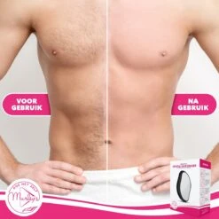 MURLEY’S Crystal Hair Removal - Krystal Remover - Haarverwijderaar - Epilator - Pijnloze En Veilige Ontharing ZWART 16 MURLEY’S Crystal Hair Removal - Krystal Remover - Haarverwijderaar - Epilator - Pijnloze En Veilige Ontharing ZWART -Verzorgingsproducten 1200x1200 686