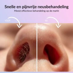 Rivema Luxe Wax Ontharing Set – Neus Ontharing – Wax Beans – Ontharingswax – Ontharen – 7 Maanden Haarvrij 11 Rivema Luxe Wax Ontharing Set – Neus Ontharing – Wax Beans – Ontharingswax – Ontharen – 7 Maanden Haarvrij -Verzorgingsproducten 1200x1200 776