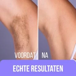 Premium Wax Set Inclusief 400gr Wax Bonen - Pre- & After-Wax Spray - 20 Aanbreng Spatels -Verzorgingsproducten 1200x1200 781