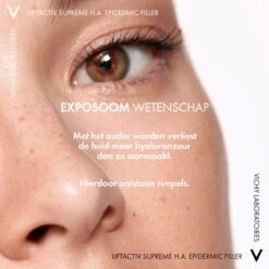 Vichy Liftactiv Supreme H.A. Epidermic Filler Serum - 30ml - Tegen Rimpels En Fijne Lijntjes, Ook Voor Gevoelige Huid 13 Vichy Liftactiv Supreme H.A. Epidermic Filler Serum - 30ml - Tegen Rimpels En Fijne Lijntjes, Ook Voor Gevoelige Huid -Verzorgingsproducten 1200x1200 829