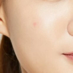 COSRX Acne Pimple Master -Verzorgingsproducten 1200x1200 855