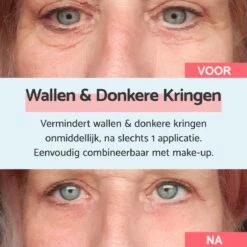 Remescar Wallen En Donkere Kringen 8ml - Crème Voor Wallen - Donkere Kringen Verwijderaar - Verwijdert Wallen Onder De Ogen - Onmiddellijke Wallen Behandeling - 180 Applicaties -Verzorgingsproducten 1200x1200 988
