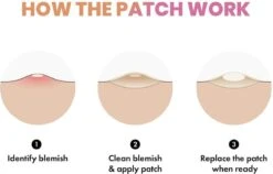 Merkloos Pimple Patch - Acne Patch - Puisten Patch - Acne Sticker - Puisten Pleister - Pimple Patches - Acne Pleister - Puisten Verwijderaar - Puisten Creme - Acne Verwijderen Set - Acneverzorging | 36 Stuks & Directe Levering -Verzorgingsproducten 1200x769 1