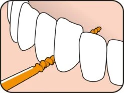 Tepe EasyPick Oranje Maat XS/S – 36 Stuks 10 Tepe EasyPick Oranje Maat XS/S – 36 Stuks -Verzorgingsproducten 1200x897 2