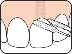 Tepe Floss Bridge & Implant 30 St -Verzorgingsproducten 1200x899 3