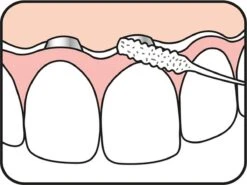 Tepe Floss Bridge & Implant 30 St -Verzorgingsproducten 1200x901 2