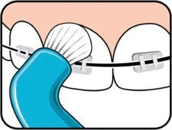 TePe Compact Tuft - Single Tufted Borstel - Tandenborstel -Verzorgingsproducten 1200x902 2