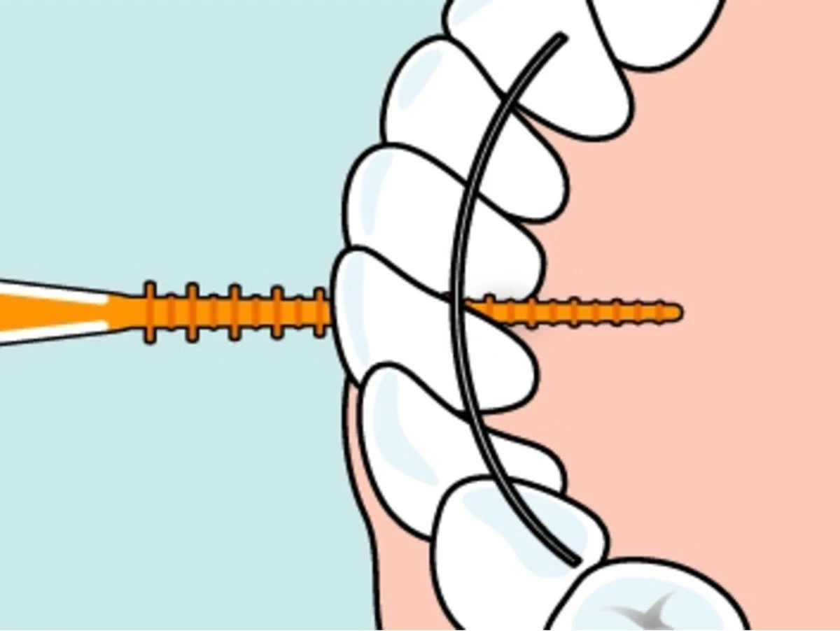 Tepe EasyPick Oranje Maat XS/S – 36 Stuks 6 Tepe EasyPick Oranje Maat XS/S – 36 Stuks - Afbeelding 6