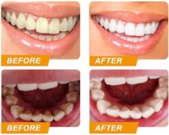 Colour Corrector - Paarse Tandpasta - Witte Tanden - Teeth Whitening - Purple Colour - Tandenbleekset -Verzorgingsproducten 1200x963