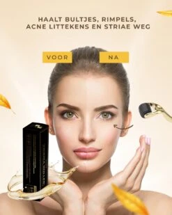 Dermaroller – 540 Micro Naalden – 0.5 MM Needle – Huidverjonging – Huidverzorging – Littekens – Striea – Steriel Verpakt -Verzorgingsproducten 960x1200 49